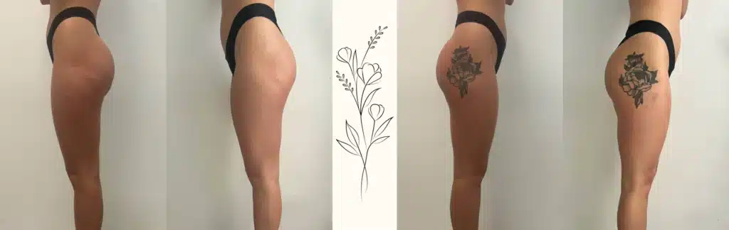 avant et après les transformationsnashi_rezultaty